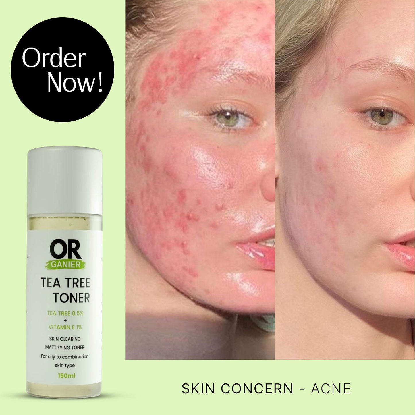 Tea Tree Toner